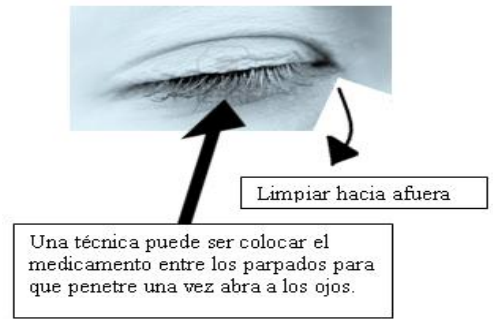 1-Administración de colirio