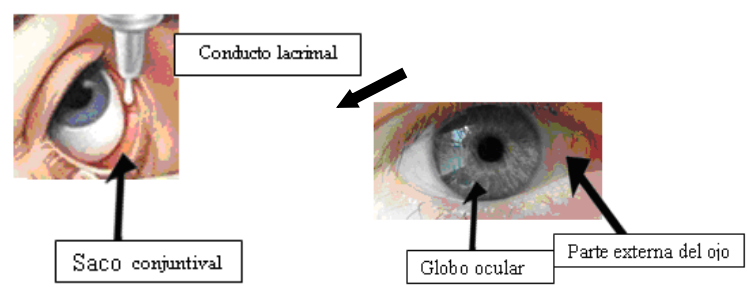 Globo ocular