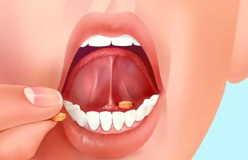 vía sublingual